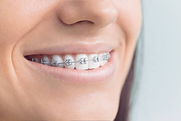 Professional Holistic Dental Care Services in Big Coppitt Key, FL